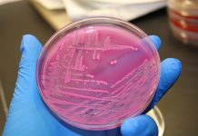 Hygiëne vakantieparken in Nederland onder de maat